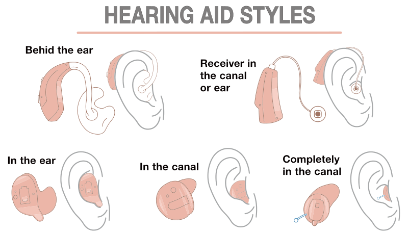 The Types of Hearing Aids image